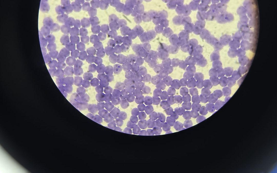 Babesioza la câine: diagnostic rapid și tratament eficient